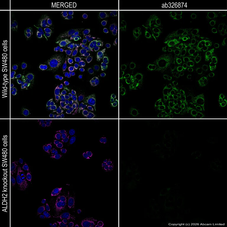 Immunocytochemistry/ Immunofluorescence - Anti-ALDH2 antibody [EPR28021A-5] (AB326874)