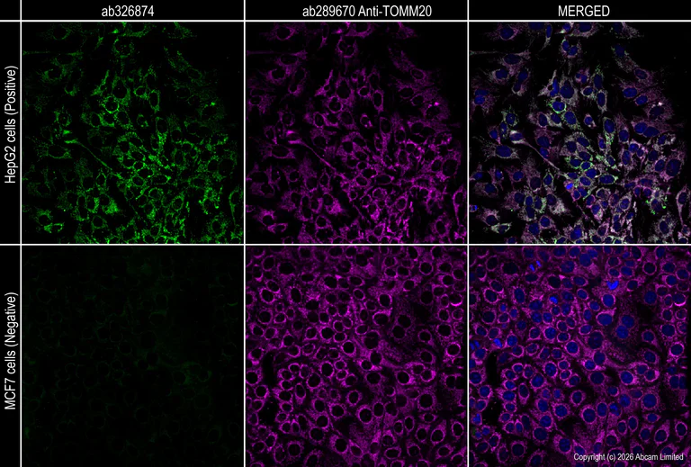 Immunocytochemistry/ Immunofluorescence - Anti-ALDH2 antibody [EPR28021A-5] (AB326874)