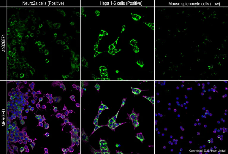 Immunocytochemistry/ Immunofluorescence - Anti-ALDH2 antibody [EPR28021A-5] (AB326874)