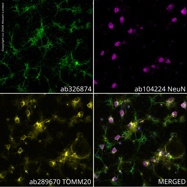 Immunocytochemistry/ Immunofluorescence - Anti-ALDH2 antibody [EPR28021A-5] (AB326874)