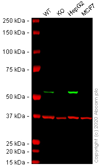 Western blot - Anti-ALDH2 antibody [EPR4494] (AB133306)