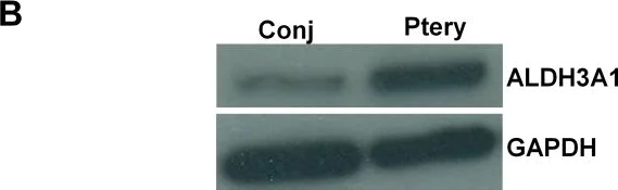 Western blot - Anti-ALDH3A1 antibody (AB76976)