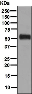 Western blot - Anti-ALDH3A1 antibody [EPR7405] (AB128902)