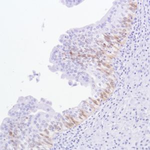Immunohistochemistry (Formalin/PFA-fixed paraffin-embedded sections) - Anti-ALDH3A1 antibody [SP298] - BSA and Azide free (AB272015), expandable thumbnail