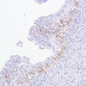 Immunohistochemistry (Formalin/PFA-fixed paraffin-embedded sections) - Anti-ALDH3A1 antibody [SP298] - BSA and Azide free (AB272015)