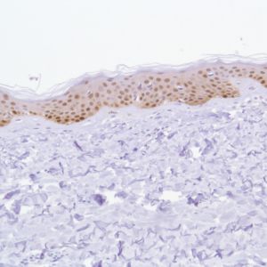 Immunohistochemistry (Formalin/PFA-fixed paraffin-embedded sections) - Anti-ALDH3A1 antibody [SP298] - BSA and Azide free (AB272015), expandable thumbnail