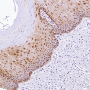 Immunohistochemistry (Formalin/PFA-fixed paraffin-embedded sections) - Anti-ALDH3A1 antibody [SP298] - BSA and Azide free (AB272015), expandable thumbnail