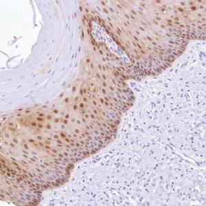 Immunohistochemistry (Formalin/PFA-fixed paraffin-embedded sections) - Anti-ALDH3A1 antibody [SP298] - BSA and Azide free (AB272015)