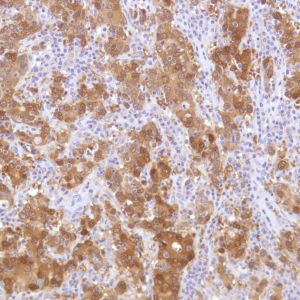 Immunohistochemistry (Formalin/PFA-fixed paraffin-embedded sections) - Anti-ALDH3A1 antibody [SP298] - BSA and Azide free (ab272015), expandable thumbnail