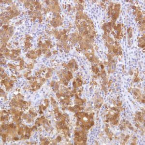 Immunohistochemistry (Formalin/PFA-fixed paraffin-embedded sections) - Anti-ALDH3A1 antibody [SP298] - BSA and Azide free (AB272015)