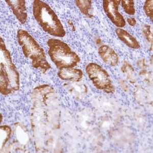 Immunohistochemistry (Formalin/PFA-fixed paraffin-embedded sections) - Anti-ALDH3A1 antibody [SP298] - BSA and Azide free (ab272015), expandable thumbnail