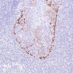 Immunohistochemistry (Formalin/PFA-fixed paraffin-embedded sections) - Anti-ALDH3A1 antibody [SP298] - BSA and Azide free (ab272015), expandable thumbnail
