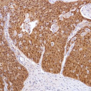 Immunohistochemistry (Formalin/PFA-fixed paraffin-embedded sections) - Anti-ALDH3A1 antibody [SP298] - BSA and Azide free (AB272015), expandable thumbnail