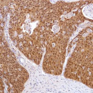 Immunohistochemistry (Formalin/PFA-fixed paraffin-embedded sections) - Anti-ALDH3A1 antibody [SP298] - BSA and Azide free (AB272015)