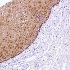 Immunohistochemistry (Formalin/PFA-fixed paraffin-embedded sections) - Anti-ALDH3A1 antibody [SP298] - BSA and Azide free (AB272015), expandable thumbnail