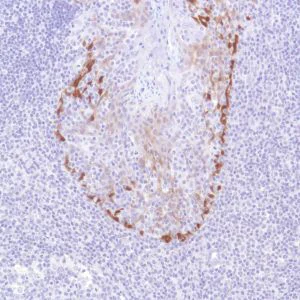 Immunohistochemistry (Formalin/PFA-fixed paraffin-embedded sections) - Anti-ALDH3A1 antibody [SP298] - C-terminal (AB227694)