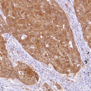 Immunohistochemistry (Formalin/PFA-fixed paraffin-embedded sections) - Anti-ALDH3A1 antibody [SP298] - C-terminal (AB227694)