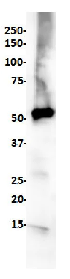 Western blot - Anti-ALDH3A1 antibody [SP298] - C-terminal (AB227694)