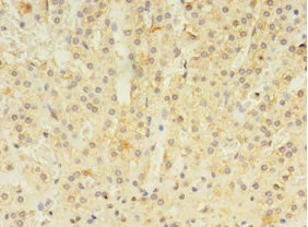 Immunohistochemistry (Formalin/PFA-fixed paraffin-embedded sections) - Anti-ALDH3B2 antibody (AB238866)