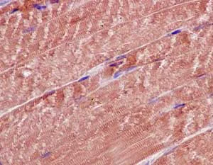Immunohistochemistry (Formalin/PFA-fixed paraffin-embedded sections) - Anti-ALDH4A1/P5CDH antibody [EPR14287] (AB185208)