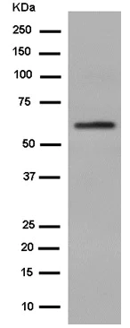 Western blot - Anti-ALDH4A1/P5CDH antibody [EPR14287] - BSA and Azide free (AB250807)
