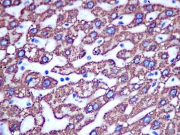 Immunohistochemistry (Formalin/PFA-fixed paraffin-embedded sections) - Anti-ALDH4A1/P5CDH antibody [EPR14288(B)] (AB181256)