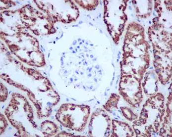 Immunohistochemistry (Formalin/PFA-fixed paraffin-embedded sections) - Anti-ALDH4A1/P5CDH antibody [EPR14288(B)] (AB181256)