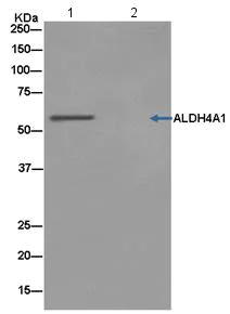 Immunoprecipitation - Anti-ALDH4A1/P5CDH antibody [EPR14288(B)] (AB181256)