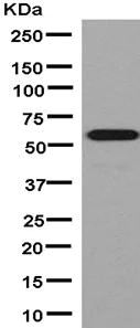 Western blot - Anti-ALDH4A1/P5CDH antibody [EPR14288(B)] (AB181256)