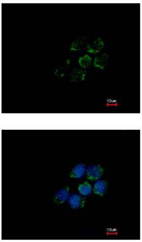 Immunocytochemistry/ Immunofluorescence - Anti-ALDH5A1/SSADH antibody (AB155493), expandable thumbnail