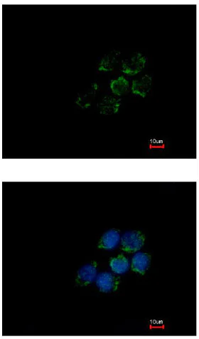Immunocytochemistry/ Immunofluorescence - Anti-ALDH5A1/SSADH antibody (AB155493)