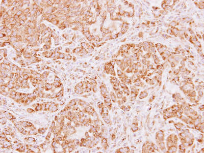Immunohistochemistry (Formalin/PFA-fixed paraffin-embedded sections) - Anti-ALDH5A1/SSADH antibody (AB155493), expandable thumbnail