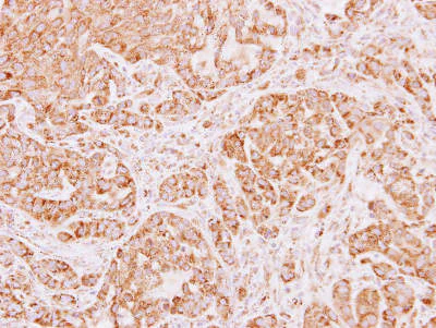 Immunohistochemistry (Formalin/PFA-fixed paraffin-embedded sections) - Anti-ALDH5A1/SSADH antibody (AB155493)
