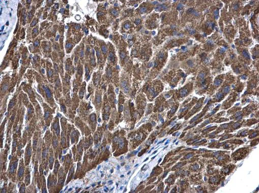 Immunohistochemistry (Formalin/PFA-fixed paraffin-embedded sections) - Anti-ALDH5A1/SSADH antibody (AB155493)