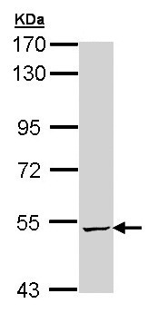 Western blot - Anti-ALDH5A1/SSADH antibody (AB155493), expandable thumbnail