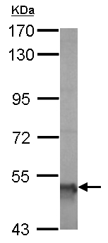 Western blot - Anti-ALDH5A1/SSADH antibody (AB155493), expandable thumbnail