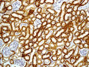 Immunohistochemistry (Formalin/PFA-fixed paraffin-embedded sections) - Anti-ALDH5A1/SSADH antibody [EPR7794] (AB129017)