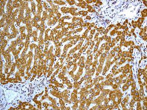 Immunohistochemistry (Formalin/PFA-fixed paraffin-embedded sections) - Anti-ALDH5A1/SSADH antibody [EPR7794] (AB129017)