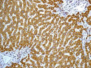 Immunohistochemistry (Formalin/PFA-fixed paraffin-embedded sections) - Anti-ALDH5A1/SSADH antibody [EPR7794] (AB129017)