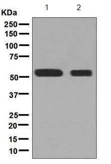 Western blot - Anti-ALDH5A1/SSADH antibody [EPR7794] (AB129017)