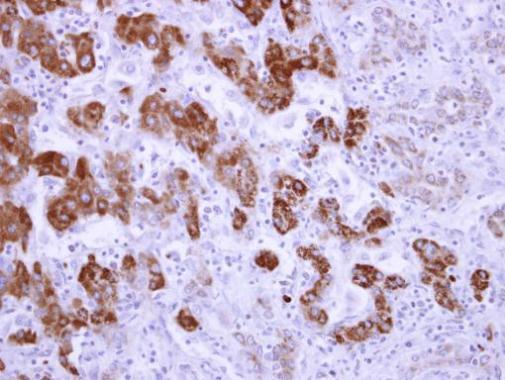 Immunohistochemistry (Formalin/PFA-fixed paraffin-embedded sections) - Anti-ALDH6A1 antibody (AB228584)
