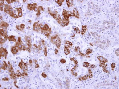 Immunohistochemistry (Formalin/PFA-fixed paraffin-embedded sections) - Anti-ALDH6A1 antibody (AB228584)