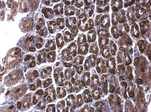 Immunohistochemistry (Formalin/PFA-fixed paraffin-embedded sections) - Anti-ALDH6A1 antibody (AB228584)