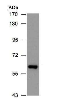 Western blot - Anti-ALDH6A1 antibody (AB228584)