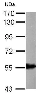 Western blot - Anti-ALDH6A1 antibody (AB228584)