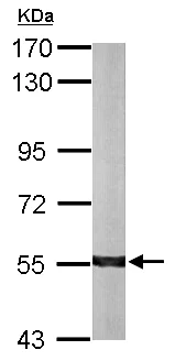 Western blot - Anti-ALDH7A1 antibody (AB154264)