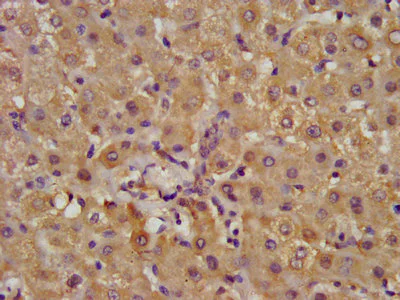 Immunohistochemistry (Formalin/PFA-fixed paraffin-embedded sections) - Anti-ALDH7A1 antibody (AB236663)