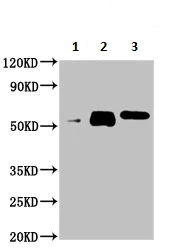 Immunoprecipitation - Anti-ALDH7A1 antibody (AB236663)