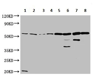 Western blot - Anti-ALDH7A1 antibody (AB236663)
