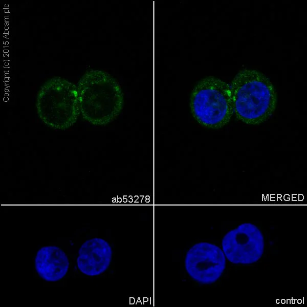 Immunocytochemistry/ Immunofluorescence - Anti-ALDH7A1 antibody [EP1935Y] (AB53278)